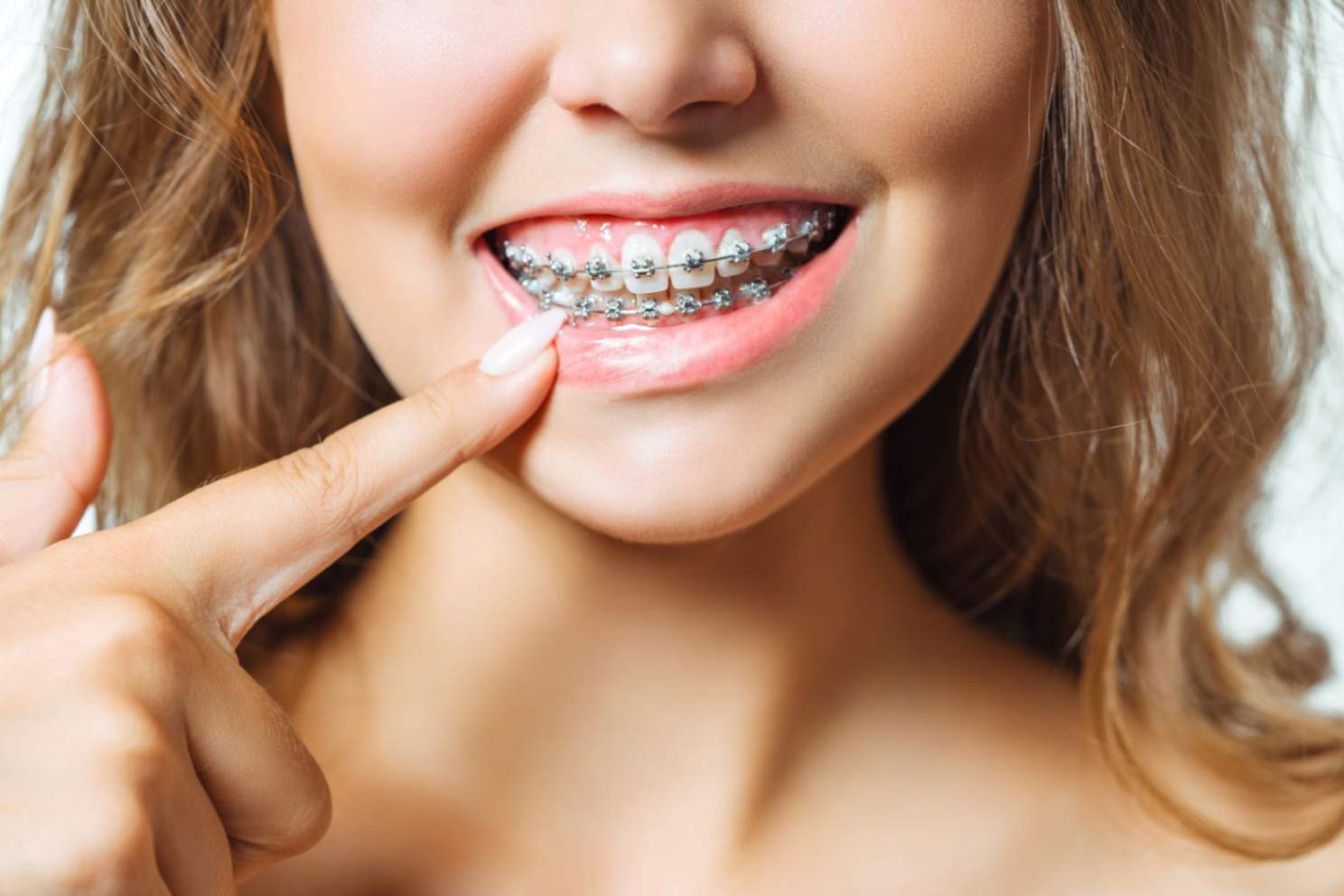 Orthodontic treatment